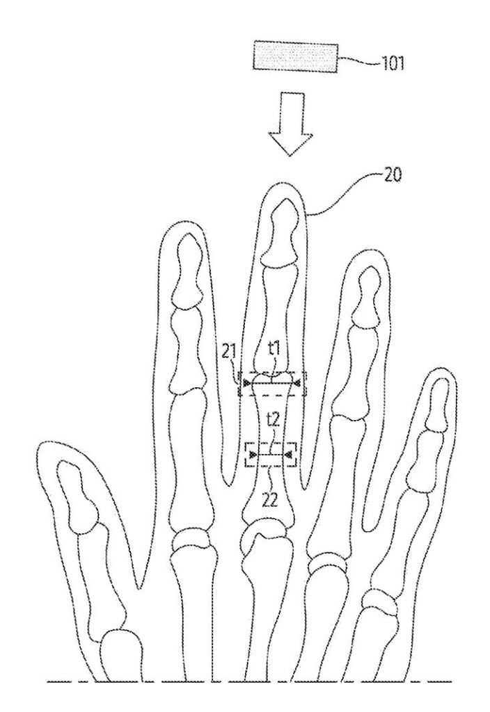 三星智慧戒指新专利曝光，Galaxy Ring 可调整指围